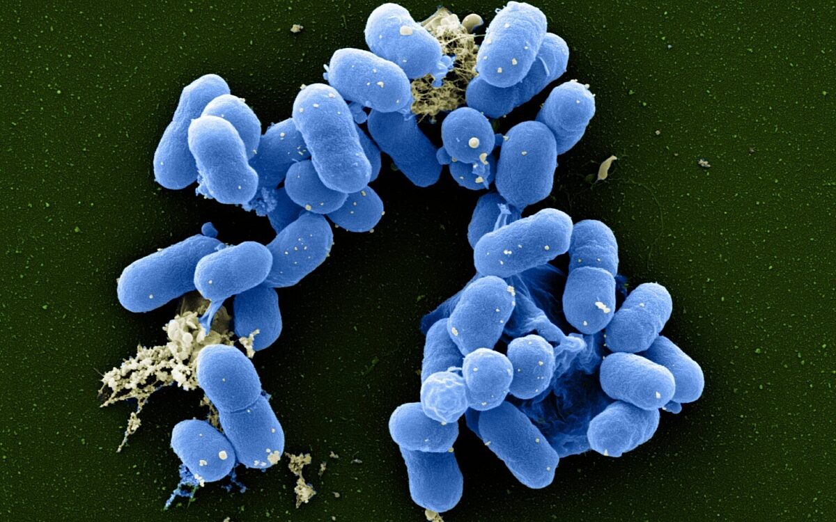 EHEC Erreger 2025 EHEC Erreger 2025