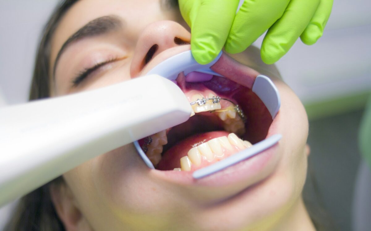 Mädchen bekommt eine Zahnspange Kieferorthopädie Mädchen bekommt eine Zahnspange Kieferorthopädie