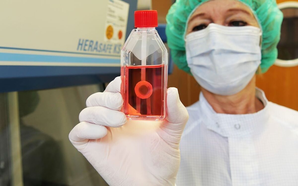 Ein Hornhauttransplantat in einer Klinik Ein Hornhauttransplantat in einer Klinik